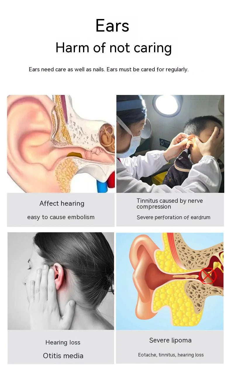 Wireless Smart HD Ear Endoscope