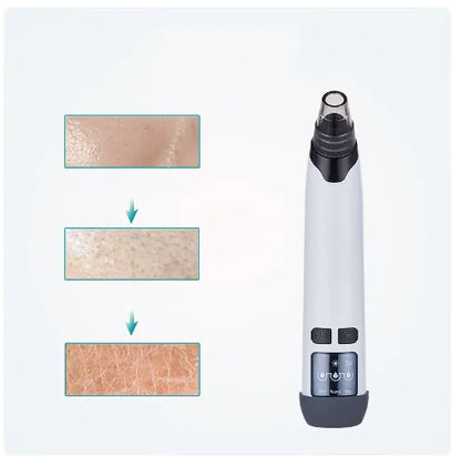 Blackhead Remover Vacuum Suction