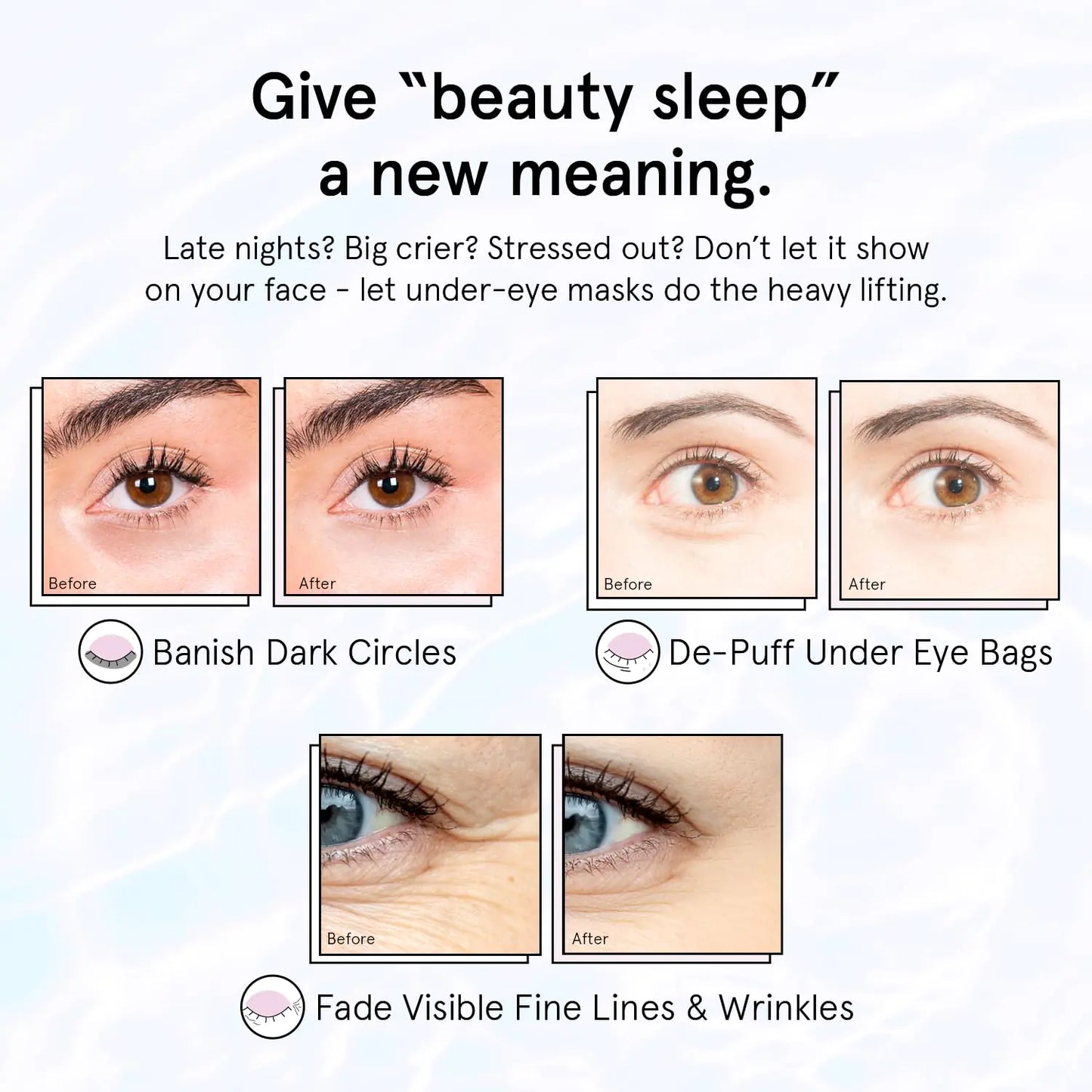 grace & stella Eye Treatment Gels - Dermatologist Tested - Under Eye Masks With Retinol - Restoring Under Eye Patches for Puffy Eyes and Dark Circles - Vegan, Cruelty-Free Retinol Eye Treatment Gels