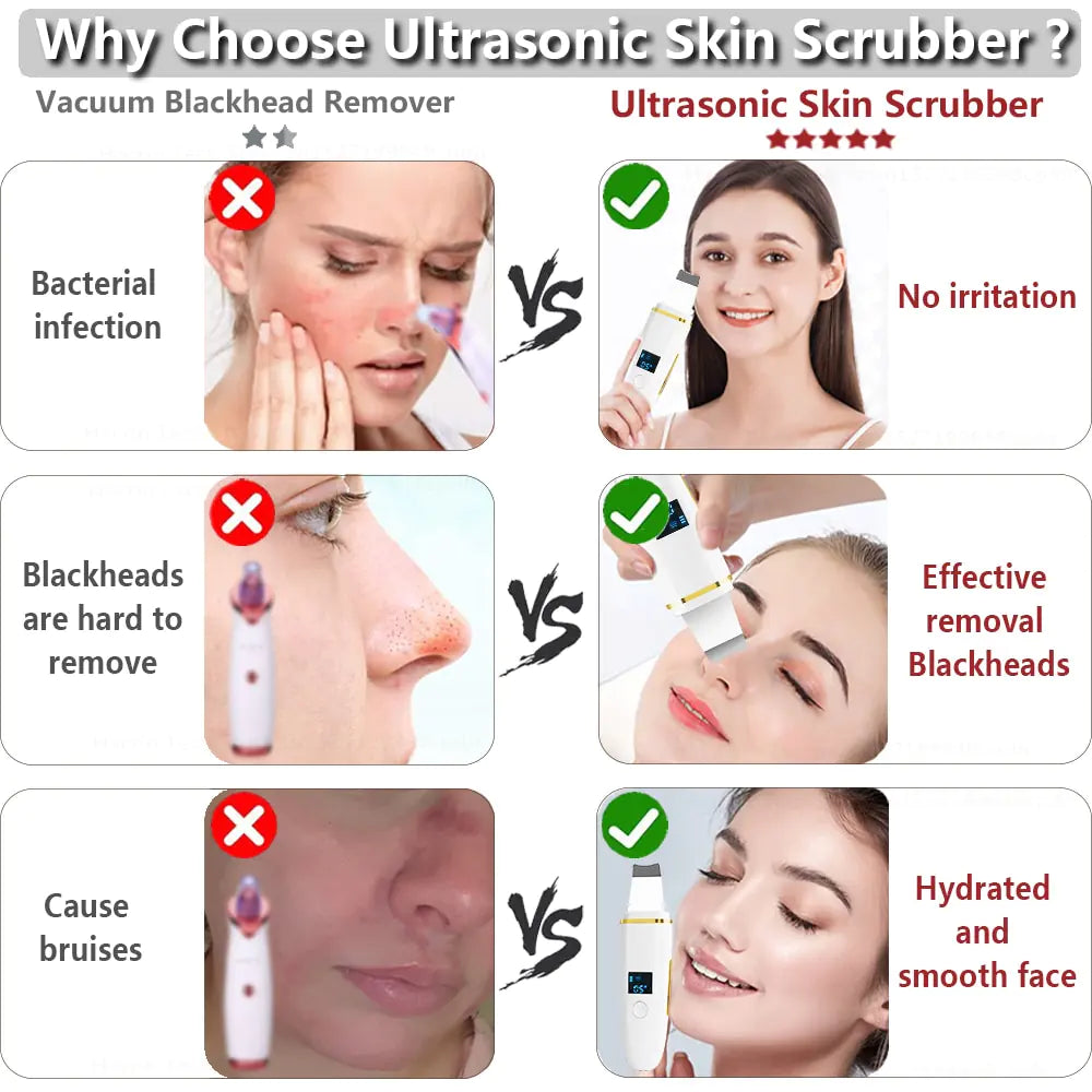 Depurador ultrasónico de piel: limpieza facial