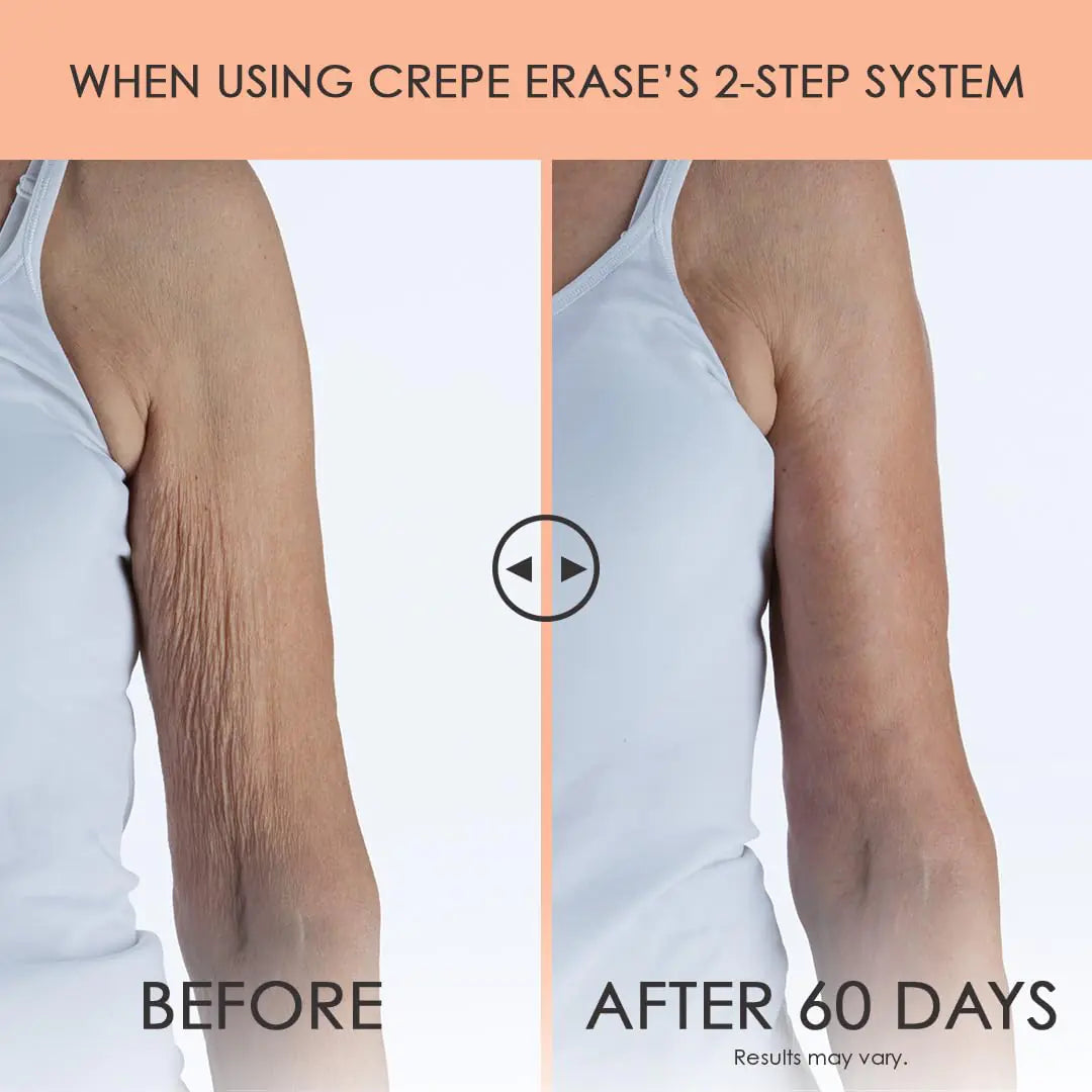 Crepe Erase Advanced Body Repair Treatment, Anti-Aging Wrinkle Cream for Face and Body, Support Skins Natural Elastin & Collagen Production - 10oz Citrus