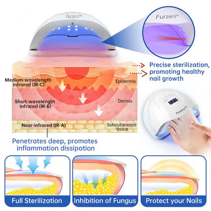 Fungus Laser Therapy Device WEM Support (www.WEM.support)