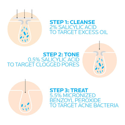 Sistema dermatológico de 3 pasos para el acné Effaclar de La Roche-Posay: limpiador para el acné con ácido salicílico, tónico reductor de poros y tratamiento localizado con peróxido de benzoilo para piel sensible (suministro para 2 meses)